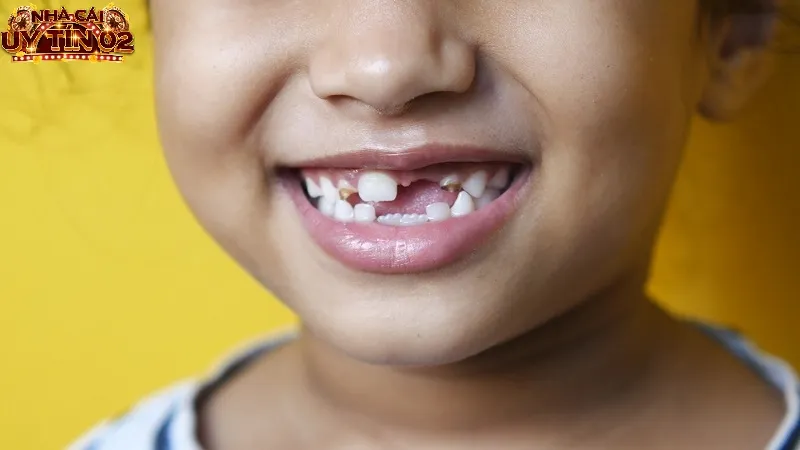 Giấc mộng thấy rụng nhiều răng là điềm không tốt