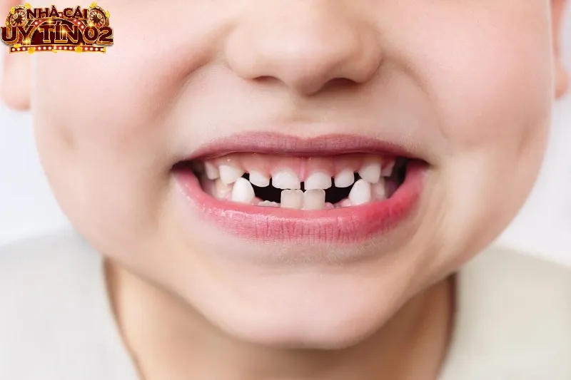 Ngủ mơ thấy rụng nhiều răng cùng lúc là điềm báo không tốt