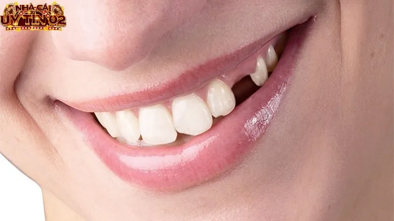 Khám phá các số đẹp khi nằm mơ thấy rụng răng